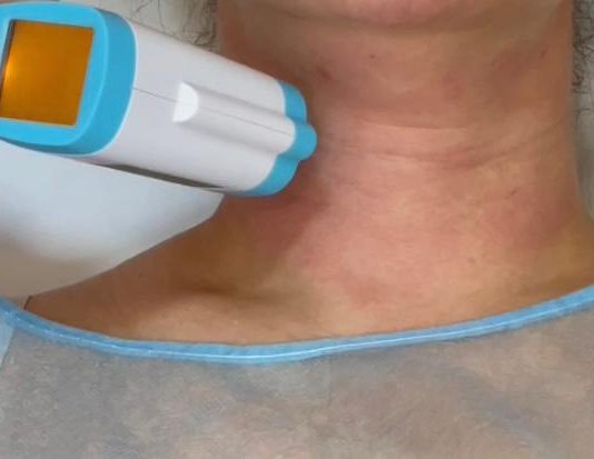 Tratamente cu laserul Skin Tightening, destinate persoanelor ce nu au nevoie de intervenții chirurgicale tip lifting, în Centrul Medical Dr. Ianoși